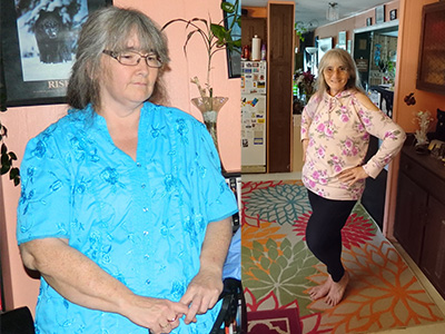 Two photos of a woman showing a before and after transformation.
